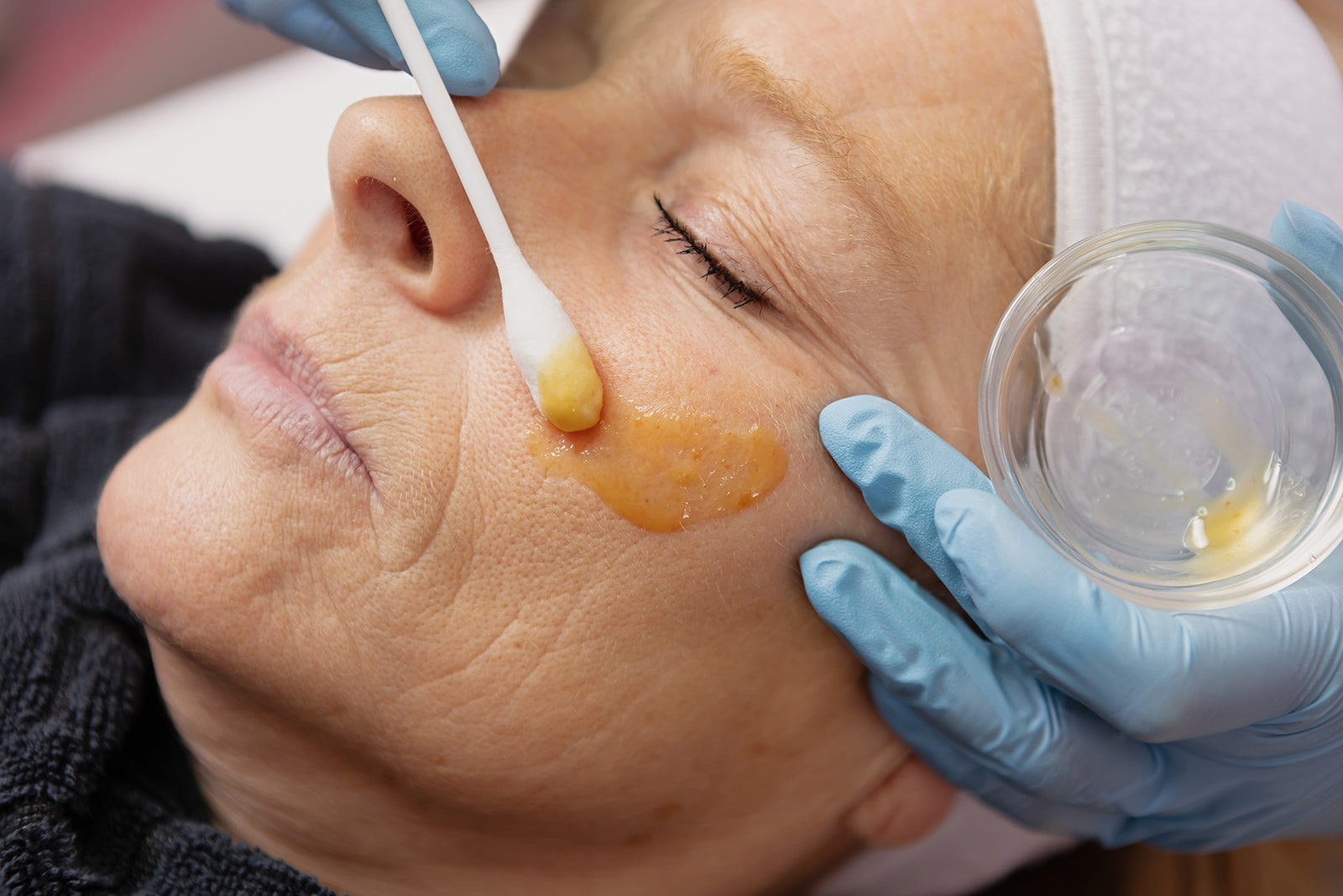 Vette huid en poriën: dit werkt écht